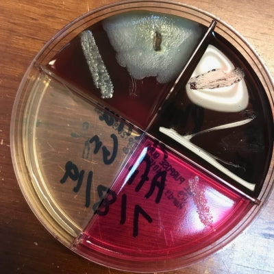 Donate $100 for bacterial cultures and other tests