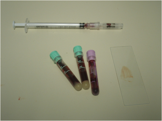 Donate $150 for bloodwork with Complete Blood Count